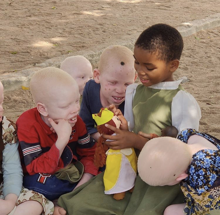 Goede doel, unity for albinism, Juliette den Ouden, JDO academy